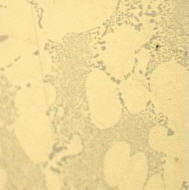Figure 5, Sample II showing the coarse microstructure, Light microscope 250X.