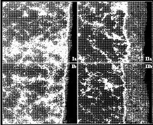 Figure 6: X-ray images for Al as seen in two fields of view (left side sample I; right side sample II)