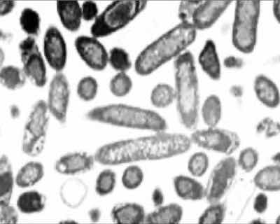 Pseudomonas bacteria.