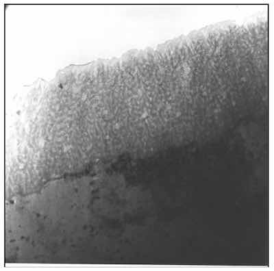 Figure 5: TEM image of a Type I or chromic acid anodic oxide. AAO produced in chromic acid doesn’t show a columnar structure, but it is spongy and porous. The random structure prohibits finish growth beyond 3 to 5 microns.