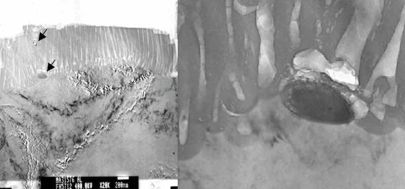 Figure 1: Precipitates which intersect the interface between the aluminum substrate and the anodic aluminum oxide (AAO) are not anodized. The anodizing reaction proceeds around the precipitate, and is included as a non-coherent particle in the AAO. Arrows in the photomicrograph on the left indicate precipitates included in the AAO finish. The photomicrograph on the right documents the activity of the anodizing reaction proceeding around the particle.