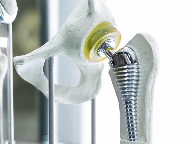 medical implant