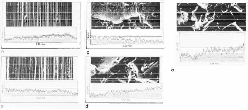 Fig. 1: SEM micrographs of substrate surface after mechanical treatment: (e) grind 2; (b) grind 1; (c) no treatment; (d) grit blasting; (e) water blasting.