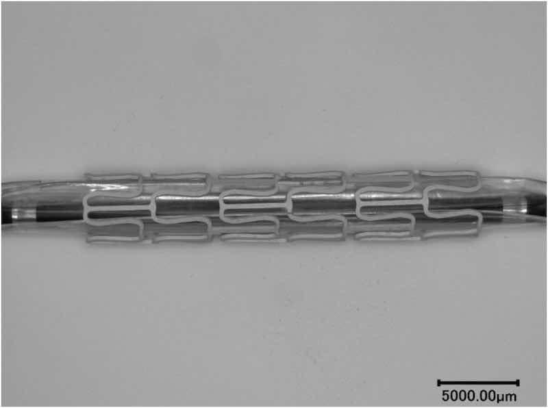 Fig. 5. PEO coated AZ31 stent attached to a balloon catheter.